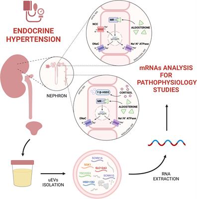 Urinary extracellular vesicles carry valuable hints through mRNA for the understanding of endocrine hypertension